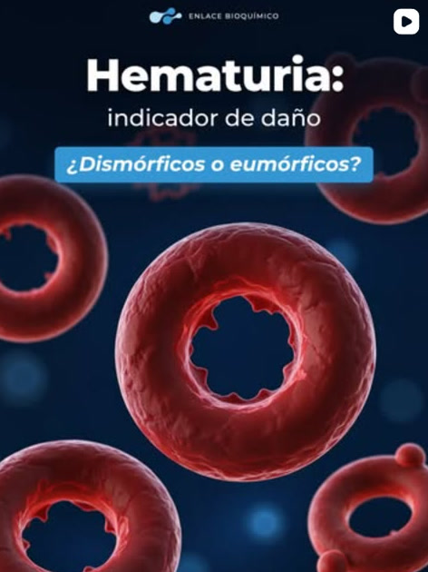 Posteo de Enlace Bioquímico sobre hematuria